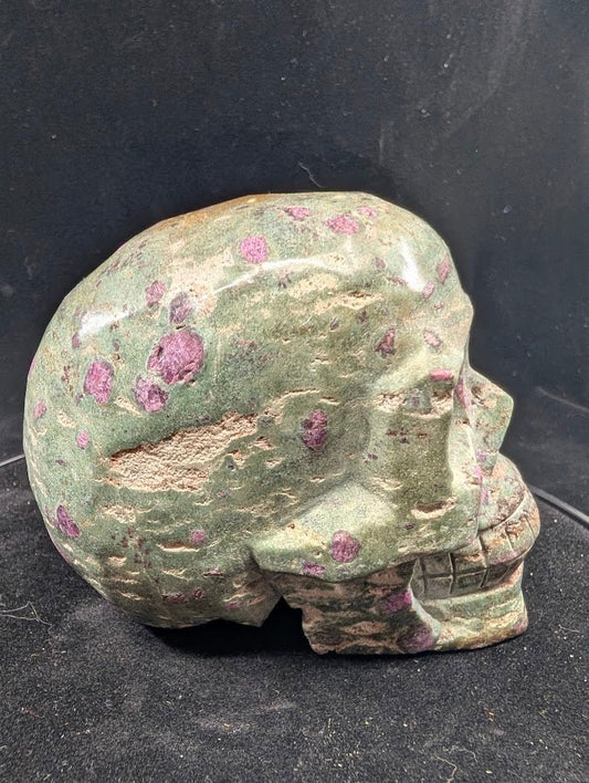 Ruby in Zoisite skull, left profile with ruby spots in green zoisite